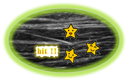 エコー・超音波画像を使用した鍼灸治療、マッサージ治療で「こり」や痛みを解消のイメージ