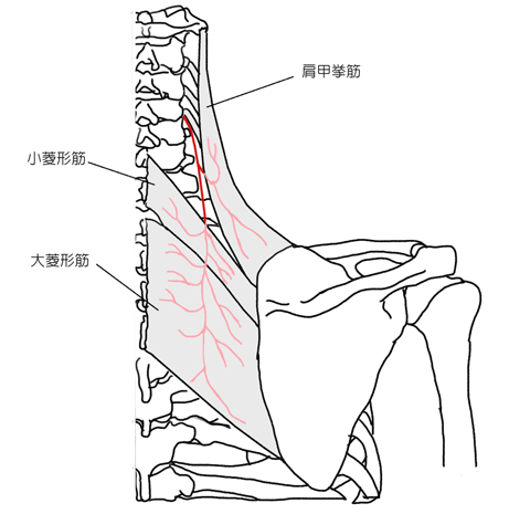肩甲背神経絞扼障害（中斜角筋貫通部）