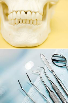 歯周病治療・歯周病予防